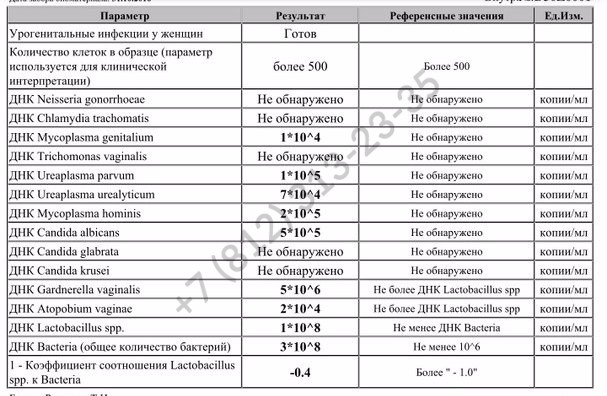 Анализ на скрытые инфекции у женщин -купить в Спб с доставкой за 1299 рублей